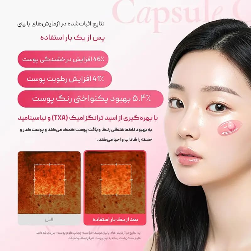 کرم کپسولی ضد لک ترانگزامیک اسید و نیاسینامید مدی‌کیوب Medicube — تصویر ۶