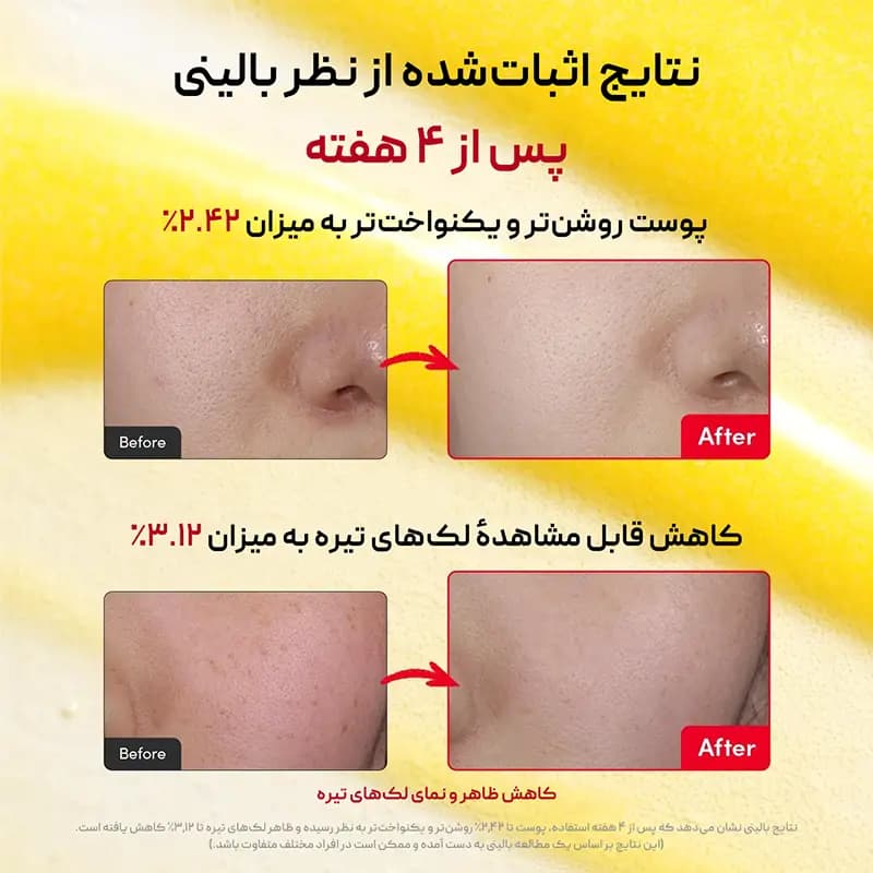 سرم روشن کننده ویتامینه اکوال بری Eqqualberry — تصویر ۵