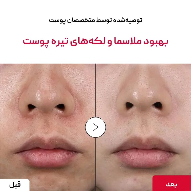 سرم روشن کننده ویتامینه اکوال بری Eqqualberry — تصویر ۳