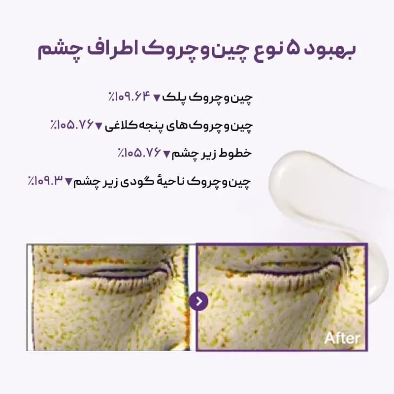 دور چشم شماره ۹ نامبوزین Numbuzin — تصویر ۲