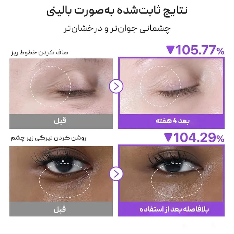 دور چشم شماره ۹ نامبوزین Numbuzin — تصویر ۵