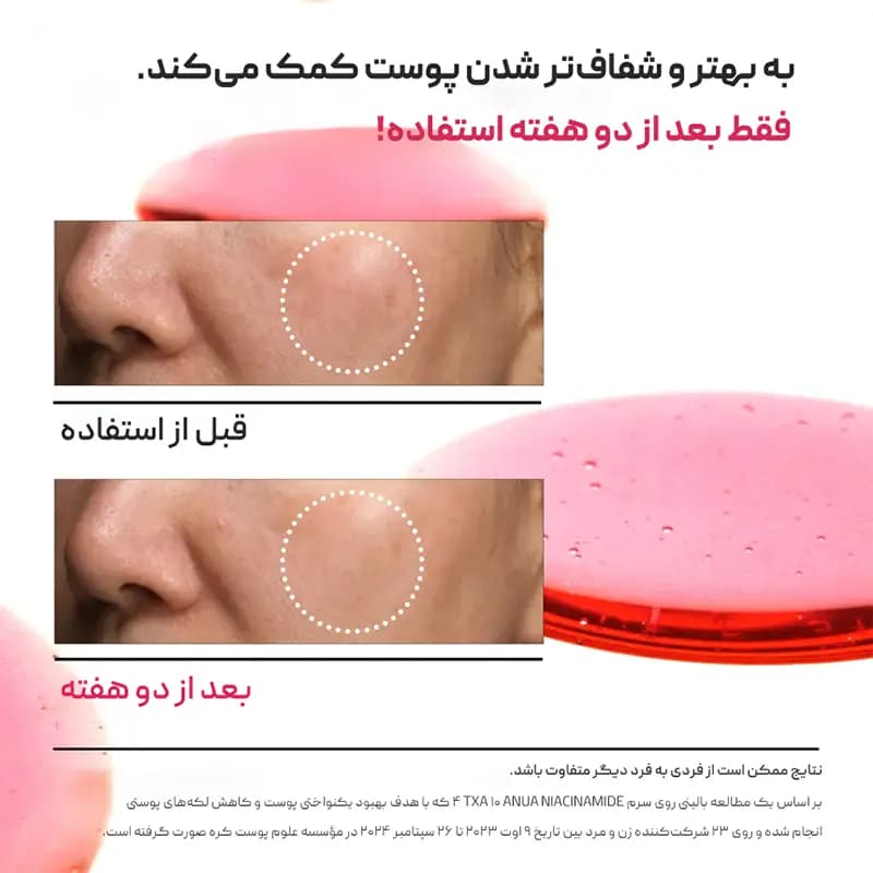 سرم نیاسینامید آنوا Anua — تصویر ۳