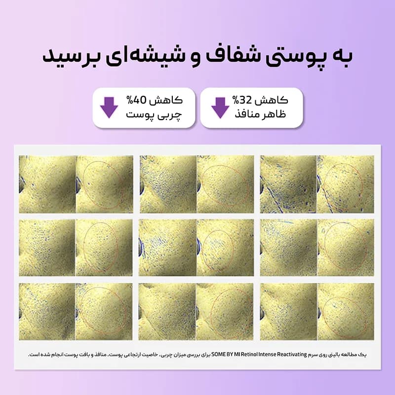 سرم رتینول سام بای می SOMEBYMI Retinol — تصویر ۴