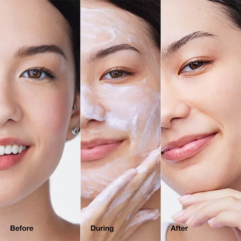موس پاک‌کننده صورت کلینیک Clinique — تصویر ۴