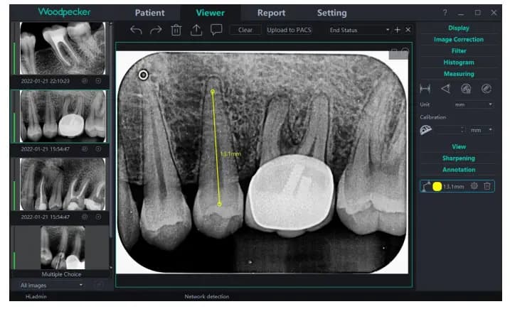 نرم افزار Aidental سنسور RVG وودپیکر