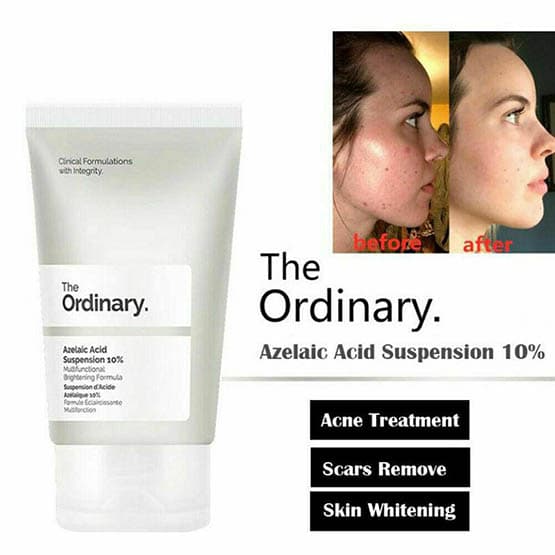 کرم آزلائیک اسید ۱۰٪ اوردینری Azelaic Acid Suspension 10% اصل — تصویر ۲