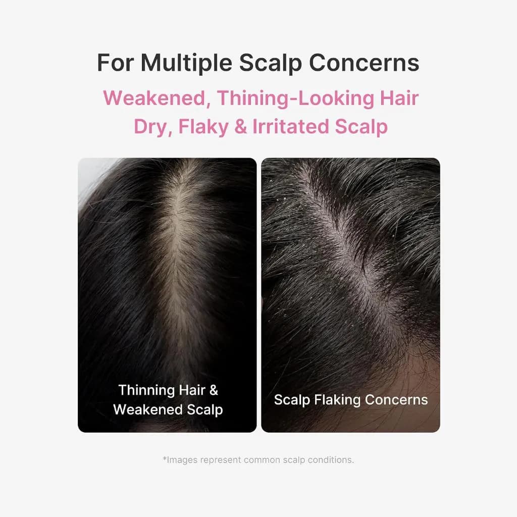 سرم تقویت کننده پوست سر مدیکیوب Rosemary PDRN Scalp Serum — تصویر ۳