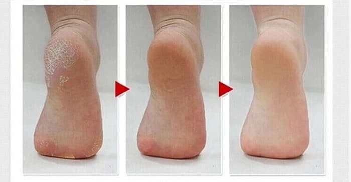 سنگ پا شارژی دو کاره flawless pedi — تصویر ۳