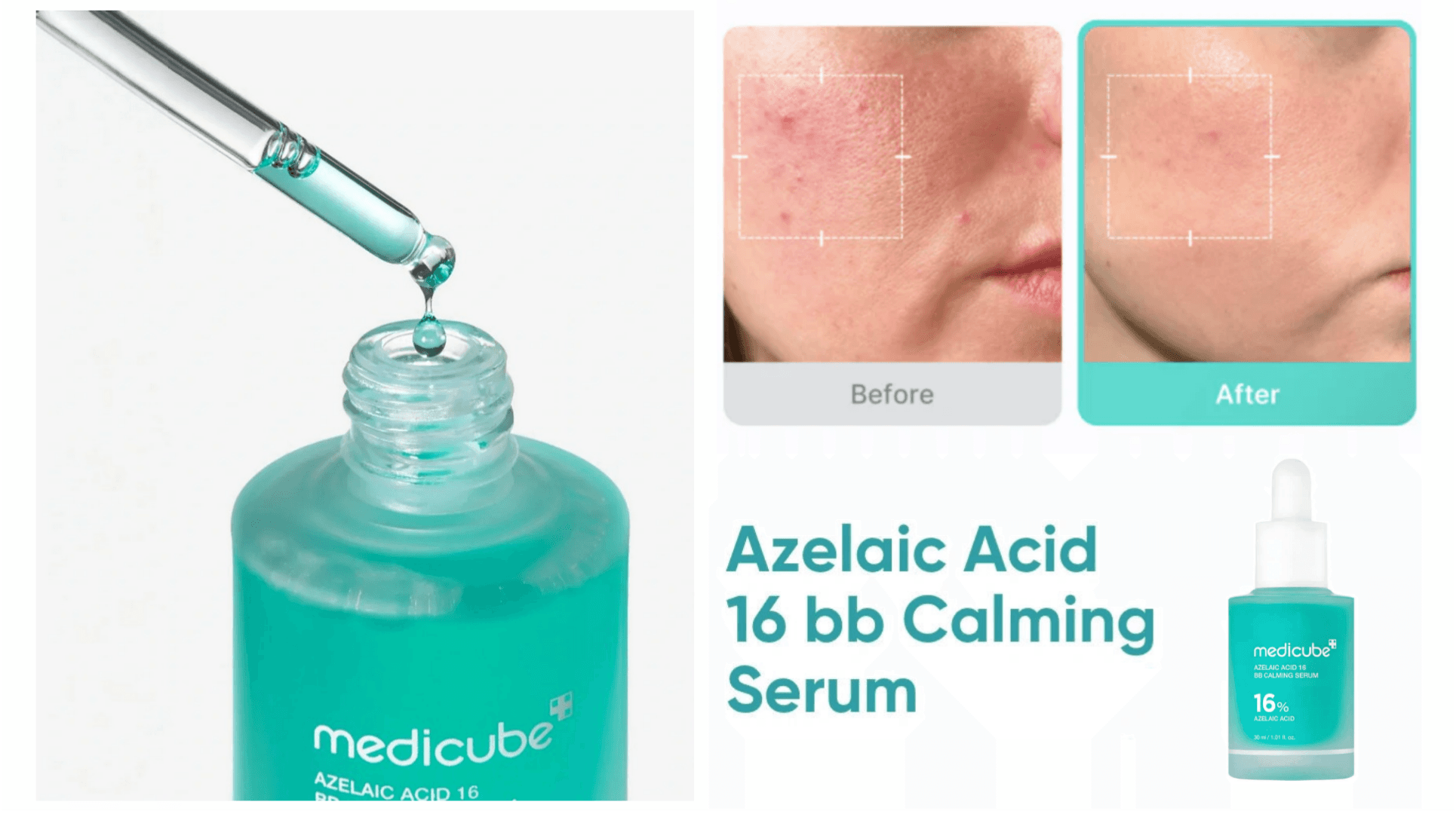 سرم تسکین دهنده و ضد جوش آزلائیک اسید مدی کیوب Medicube — تصویر ۶