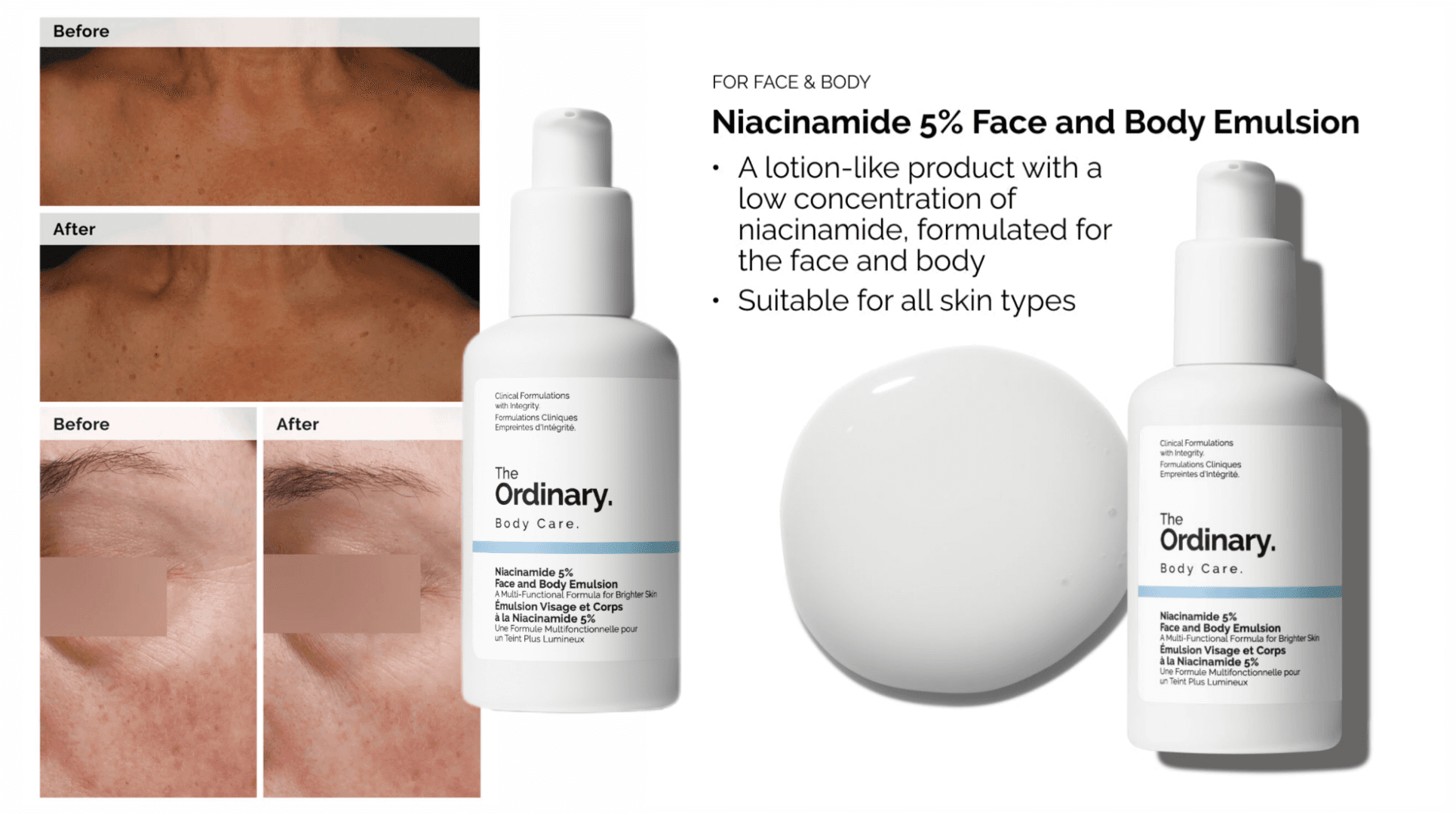 امولسیون روشن کننده صورت و بدن نیاسینامید 5% اوردینری The Ordinary — تصویر ۵