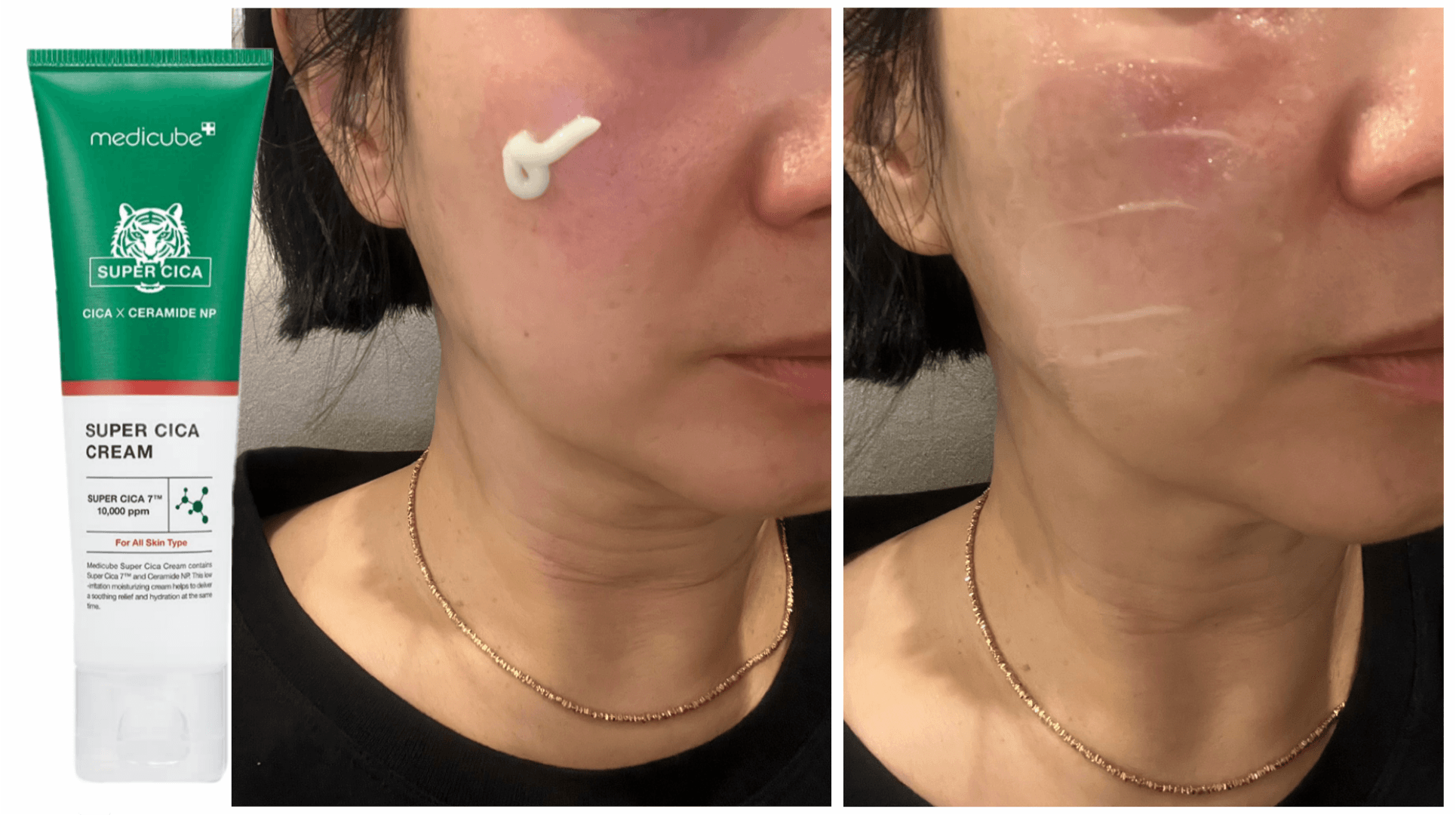 کرم ترمیم کننده و آبرسان مدل سوپر سیکا مدی کیوب Medicube — تصویر ۵
