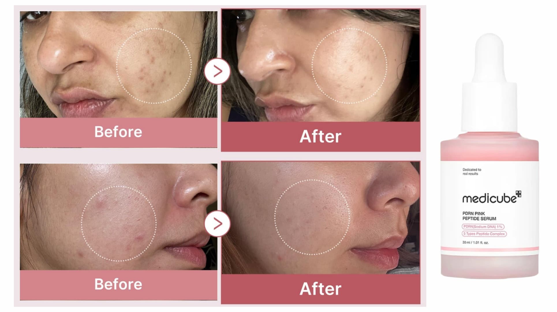سرم روشن کننده و جوانساز پپتاید و PDRN صورتی مدی کیوب Medicube — تصویر ۴