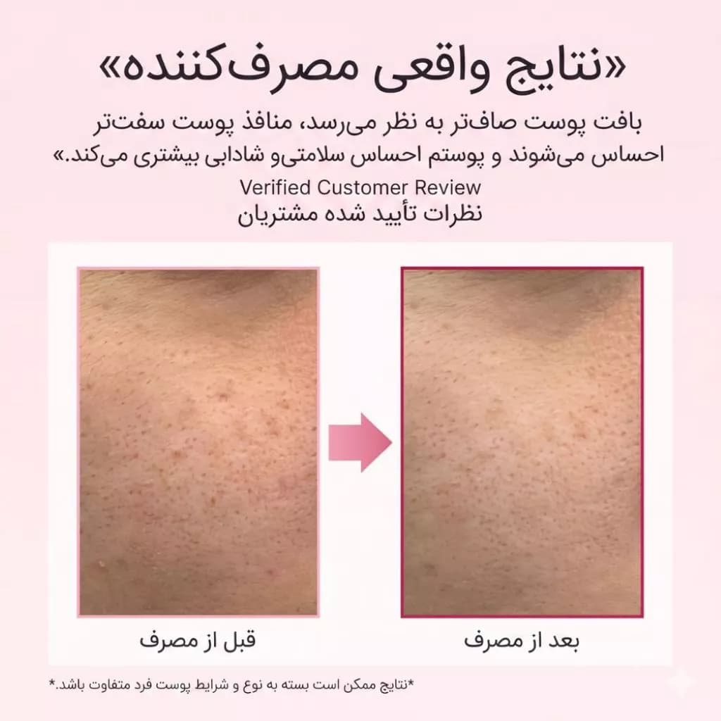 کرم مرطوب کننده و بازسازی کننده آرنسیا مدل PDRN Booster Shot — تصویر ۵