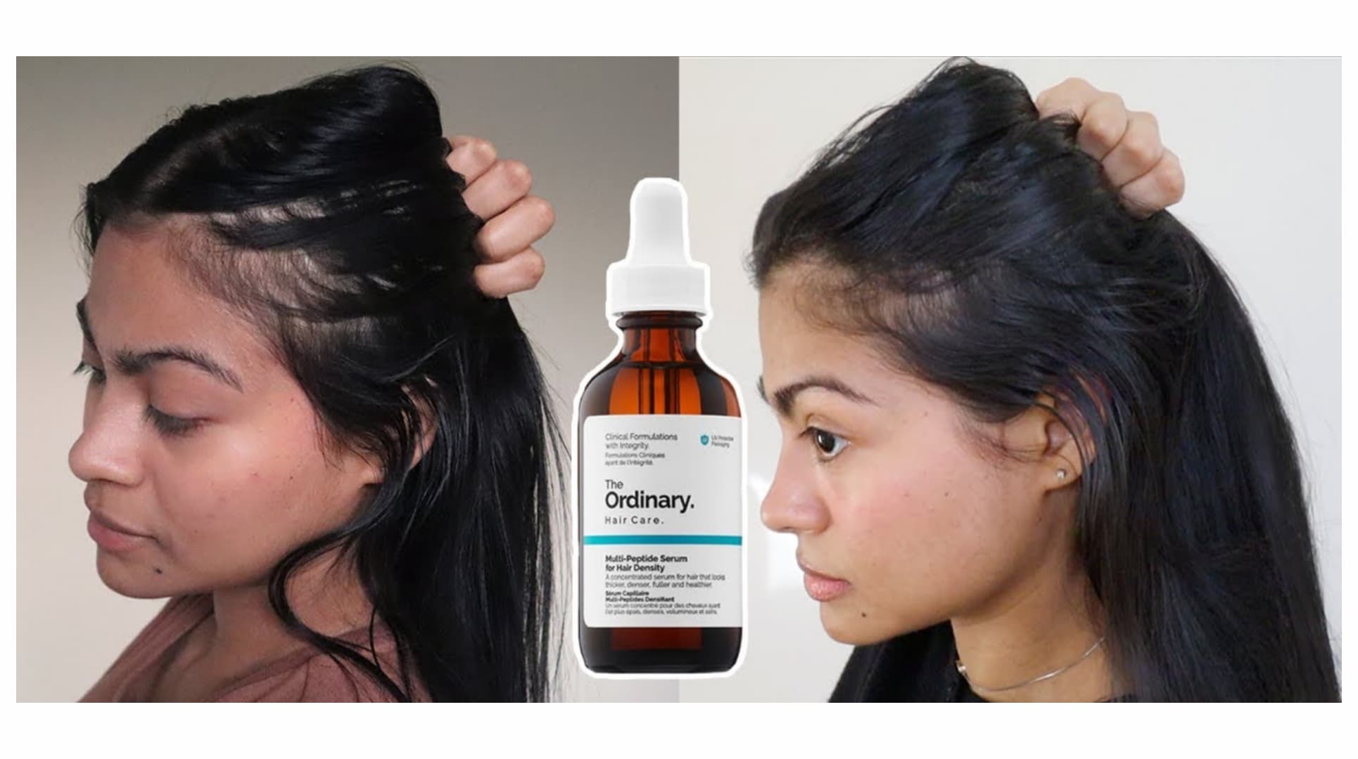 سرم ضد ریزش و ضخیم کننده مو مدل مولتی پپتید اوردینری The Ordinary — تصویر ۵