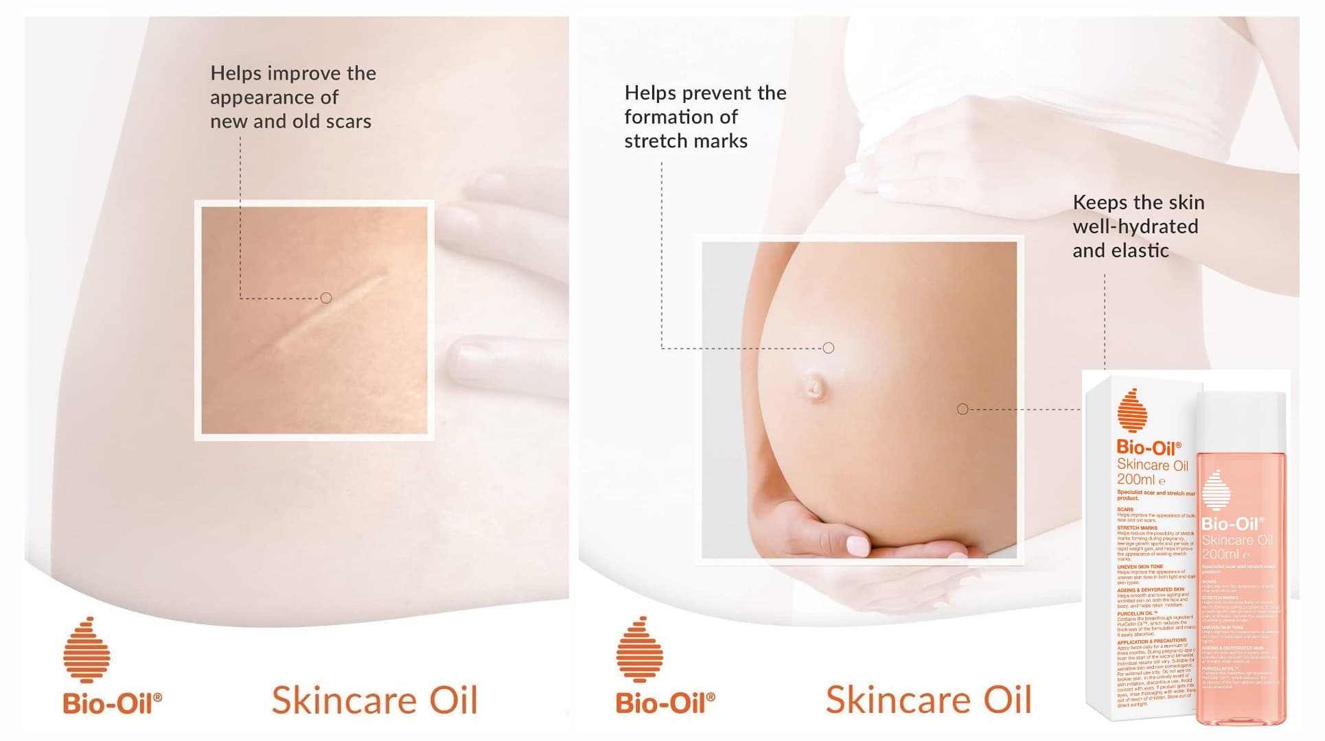 روغن ترمیم کننده و ضد ترک پوست بایو اویل Bio-Oil — تصویر ۳