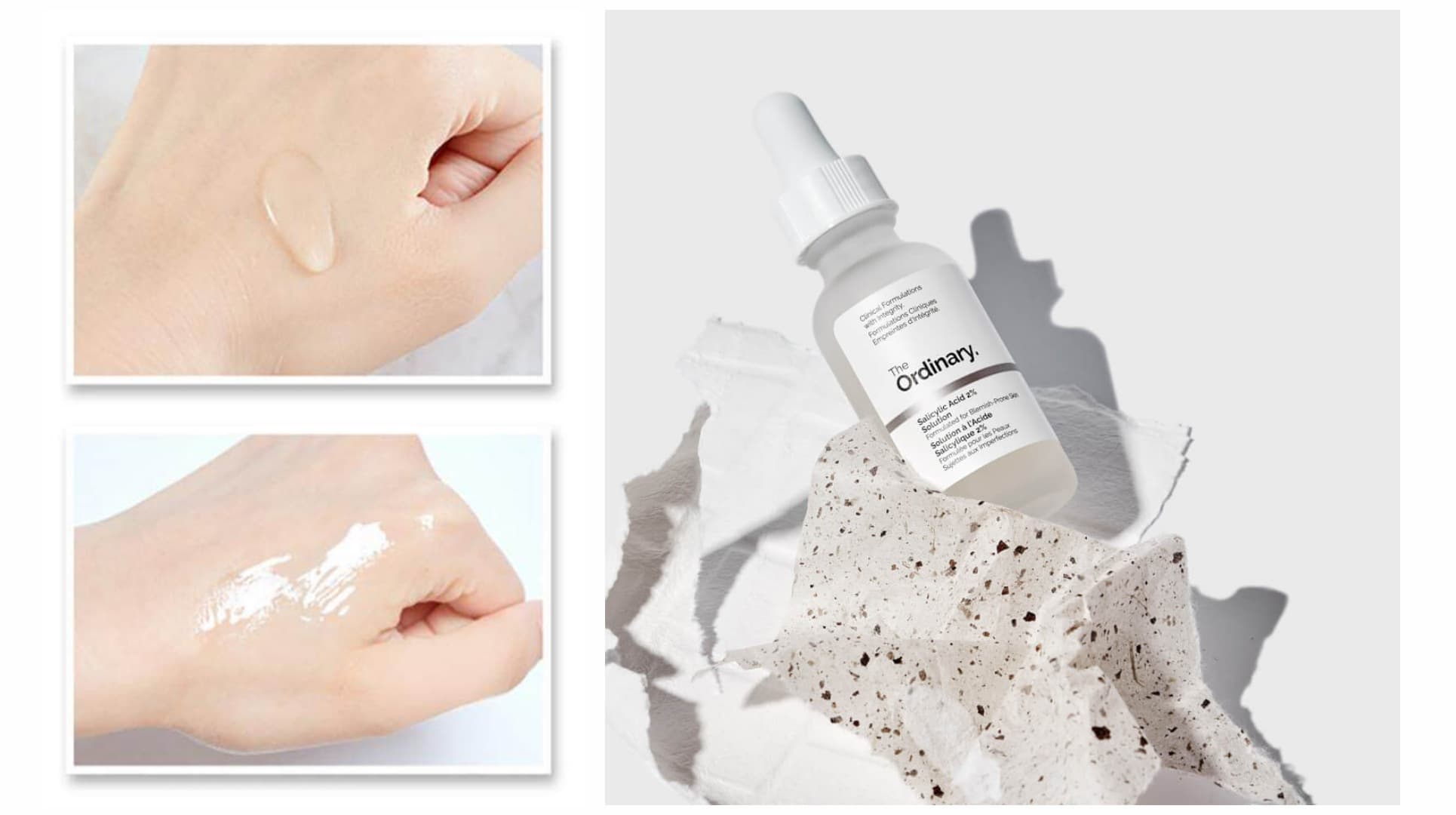 سرم لایه بردار و ضد جوش سالیسیلیک اسید 2% اوردینری The Ordinary — تصویر ۶