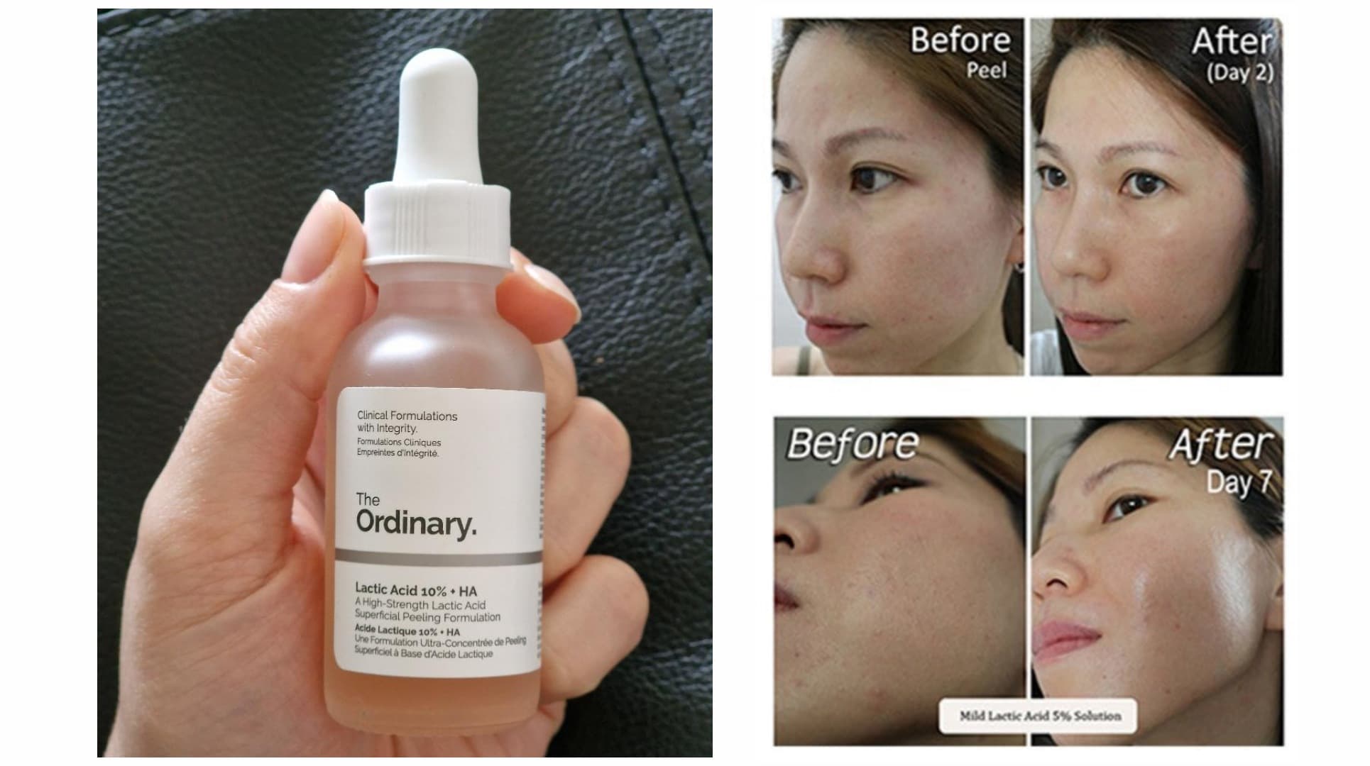 سرم لاکتیک اسید 10 درصد و هیالورونیک اسید اوردینری The Ordinary — تصویر ۴