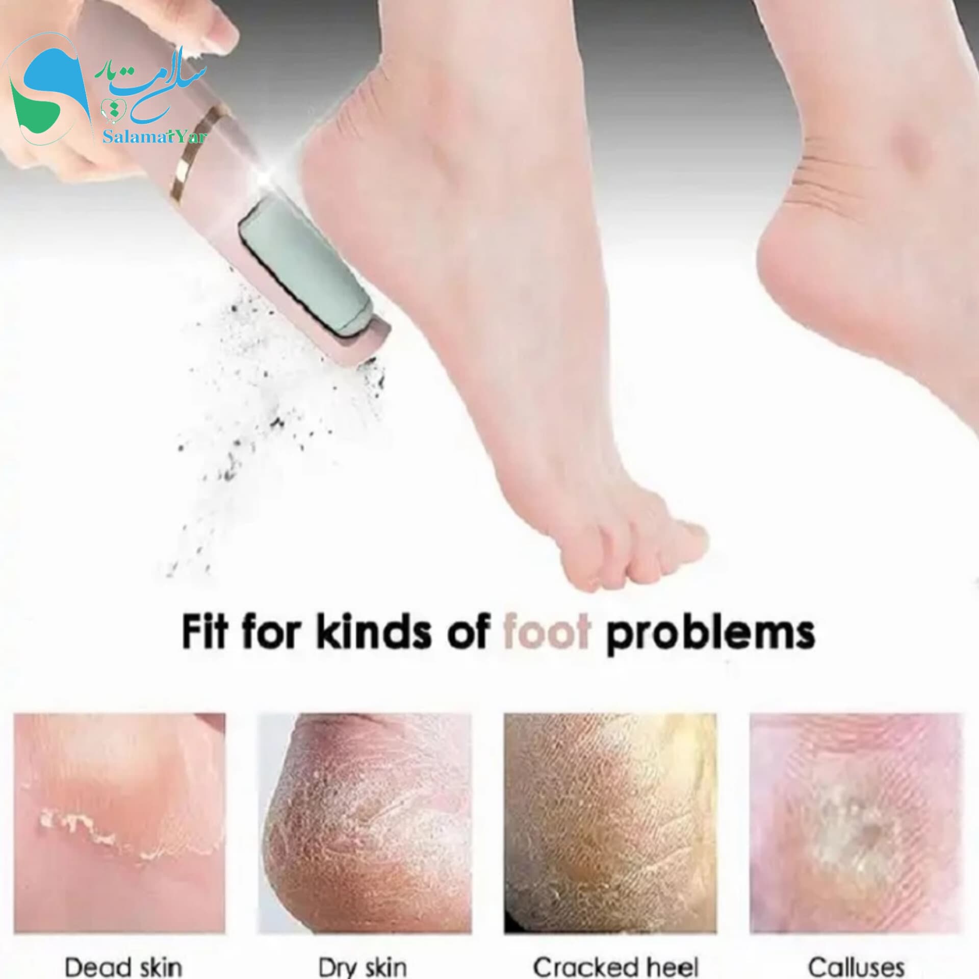 سوهان پا برقی شارژی Electric Stepping Stone Pedi — تصویر ۲