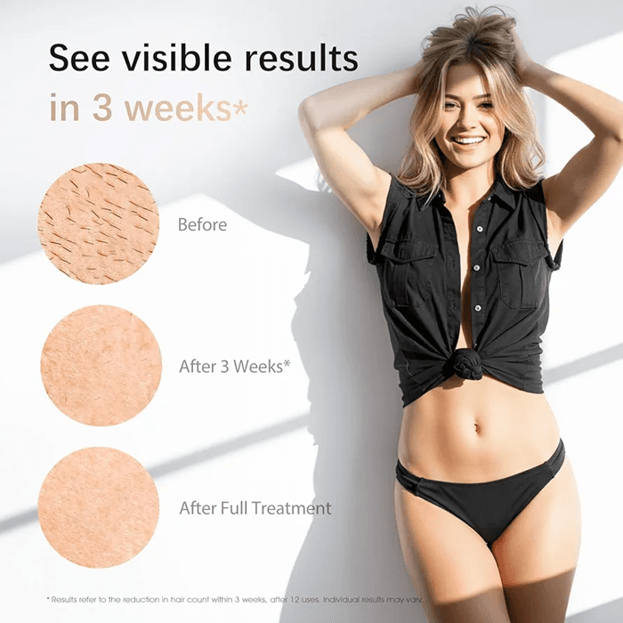دستگاه لیزر خانگی مدل Haarlosy با فناوری IPL و خنککننده یخی سفارش آلمان — تصویر ۸