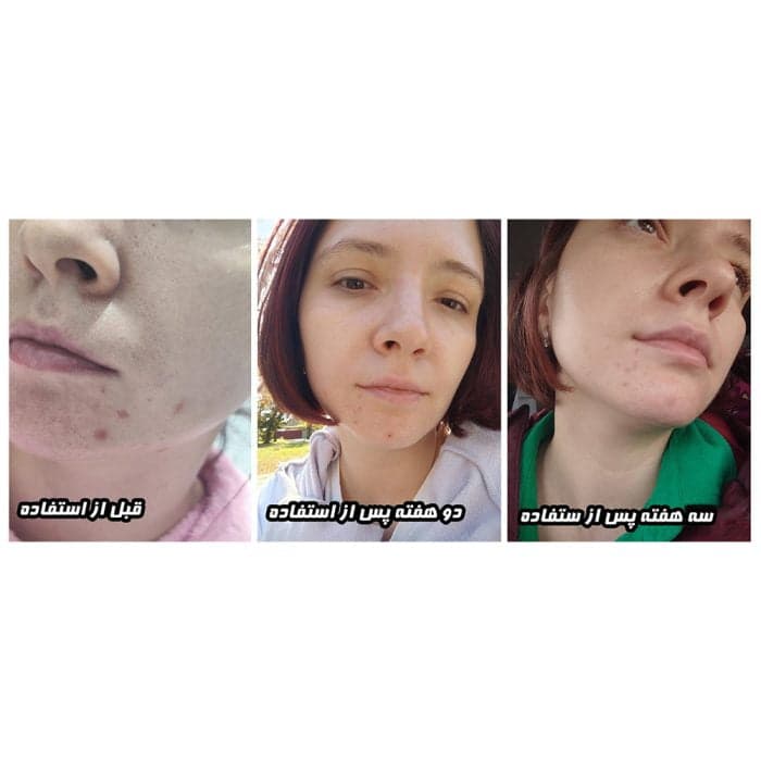 سرم روشن کننده بیوتی اف جوسان سنتلا و ویتامین سی — تصویر ۵