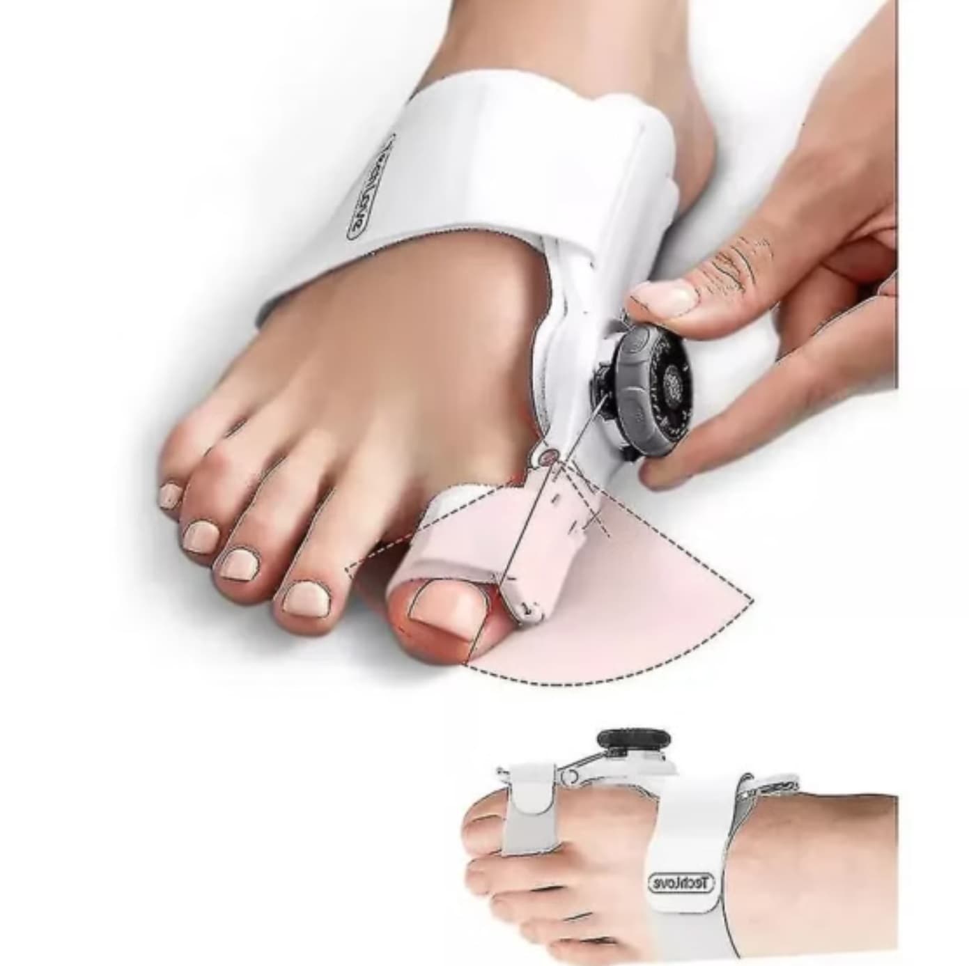 اصلاح کننده انگشت(هالوفیکس درجه 1 خارجی) BUNION CORRECTOR — تصویر ۲
