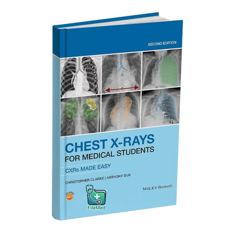 کتاب Chest X-Rays for Medical Students 2 edition