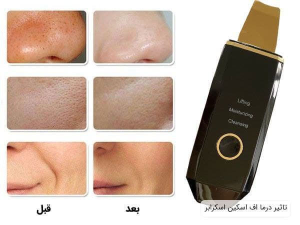 اتوی صورت یا درما اف الین تیغه گلد اسکین اسکرابر SKIN SCRUBBER — تصویر ۳