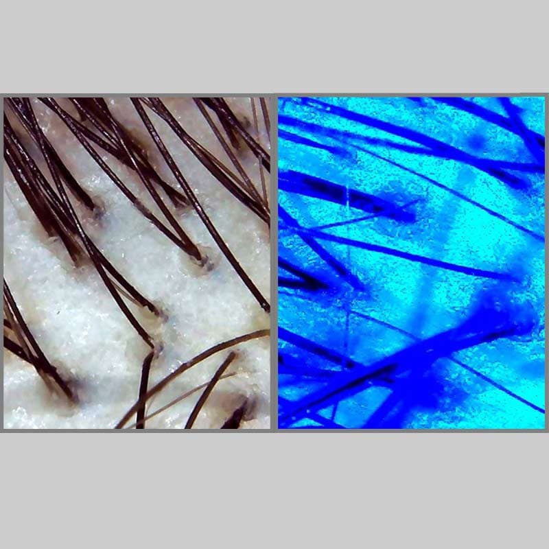 درماتوسکوپ دیجیتال (Dermatoscope) — تصویر ۴