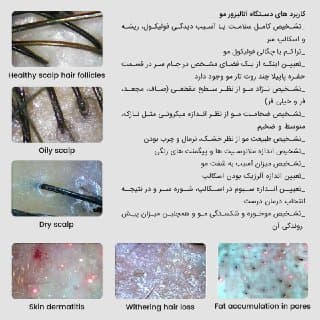 درماتوسکوپ دیجیتال (Dermatoscope) — تصویر ۳