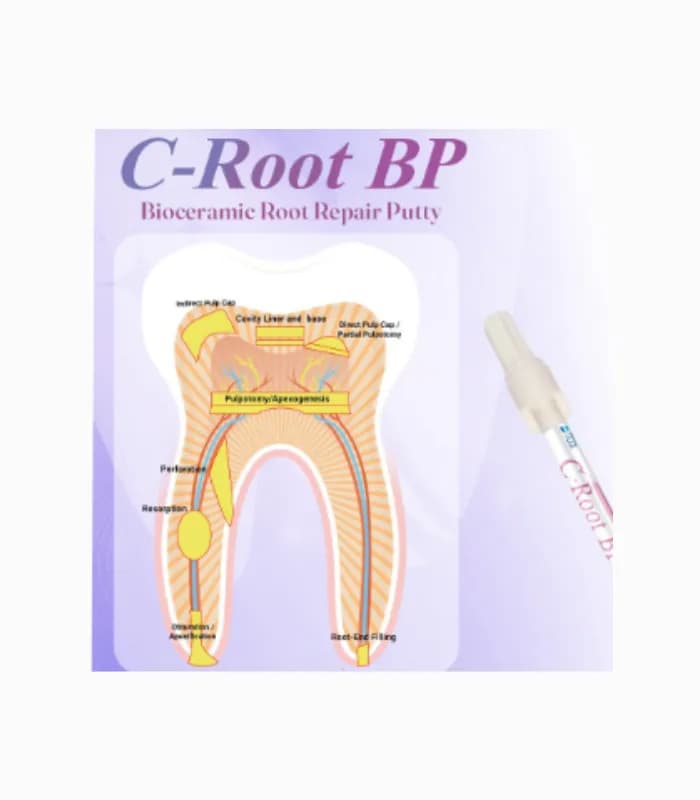 سیلر بایو سرامیک سی روت – C-Root BP — تصویر ۲