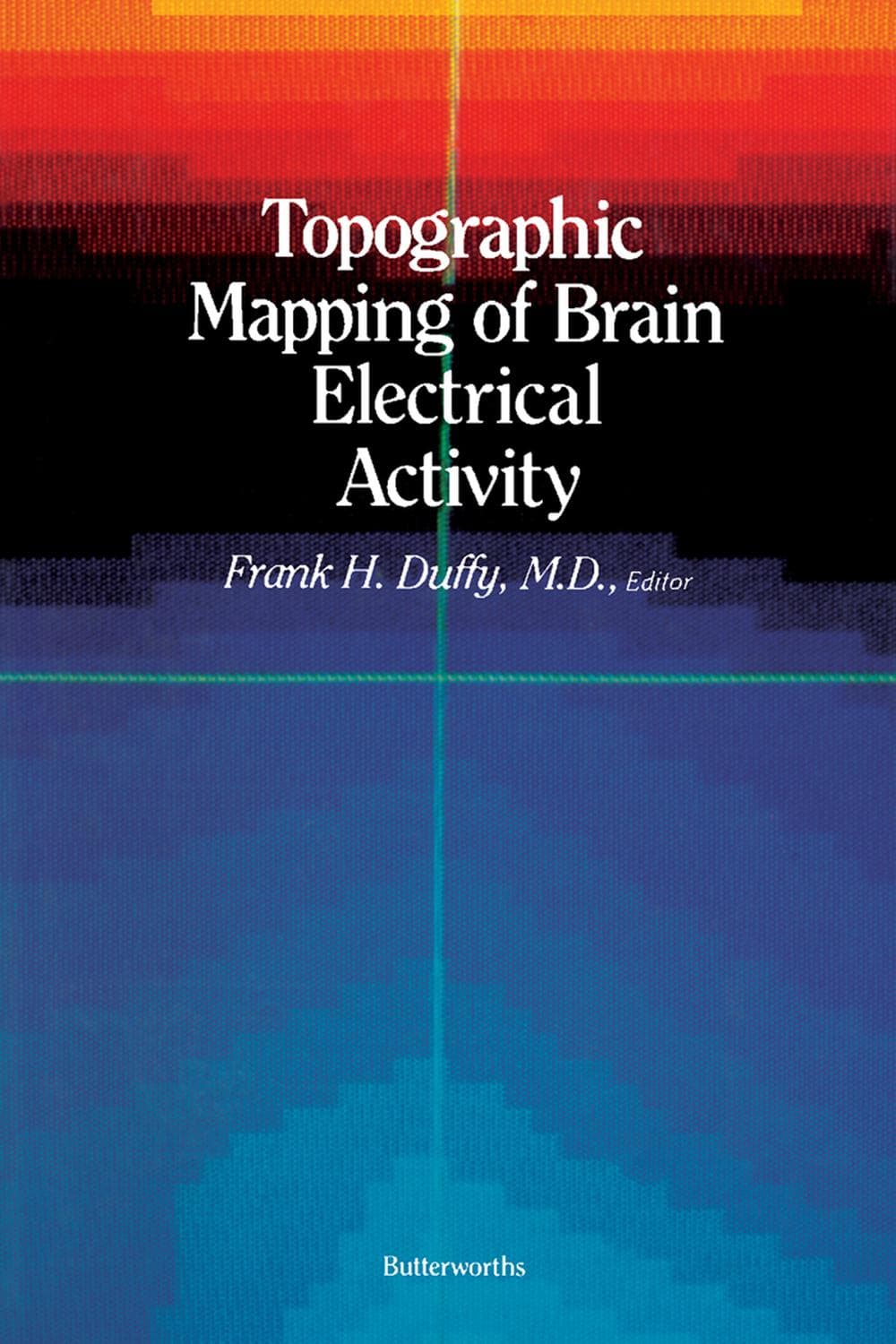 نقشهبرداری توپوگرافی فعالیت الکتریکی مغز ۲۰۱۳ <br> Topographic Mapping of Brain Electrical Activity 2013