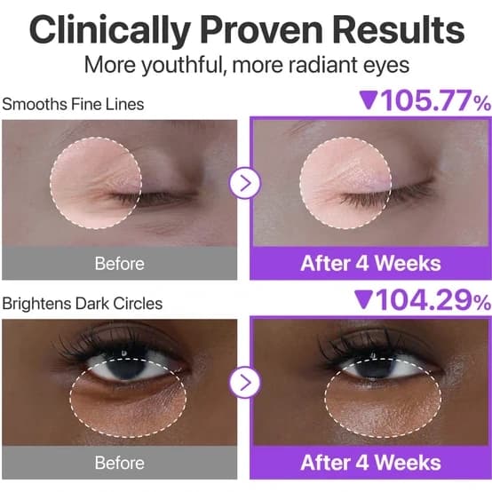 کرم دور چشم نامبوزین شماره ۹ حاوی رتینول و NAD+ حجم ۱۰ میلی‌لیتر — تصویر ۲
