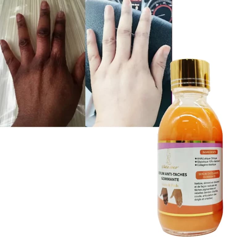 سرم سفیدکننده بدن (روشن کننده) VSC اصلی (اورجینال) — تصویر ۴