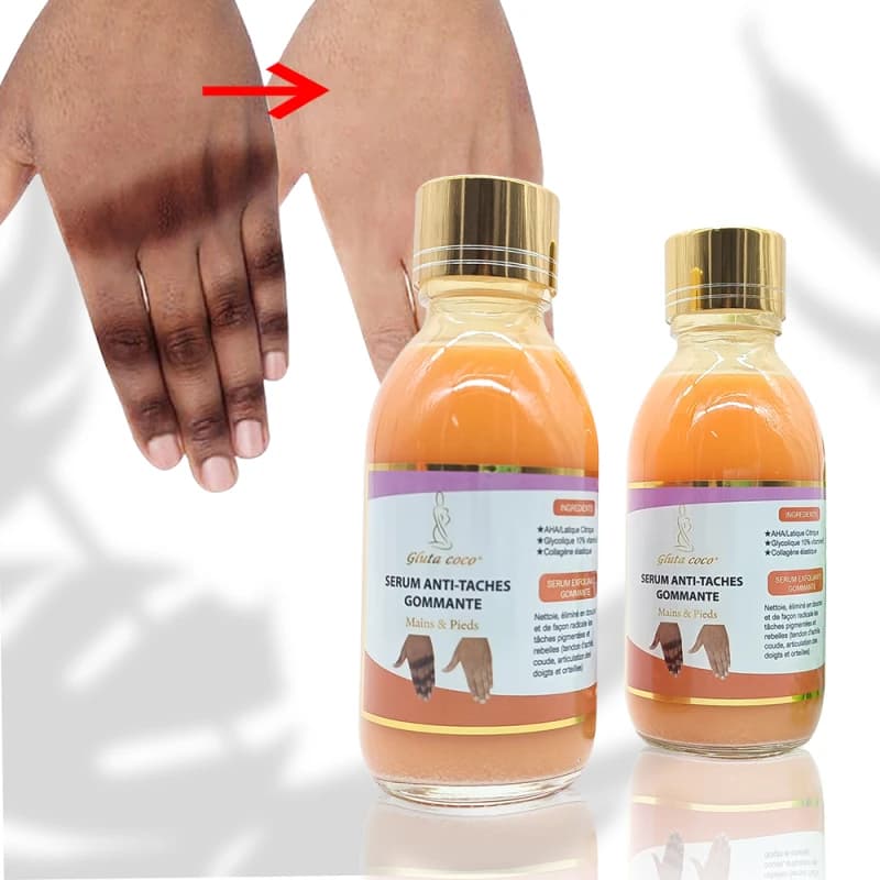سرم سفیدکننده بدن (روشن کننده) VSC اصلی (اورجینال) — تصویر ۲