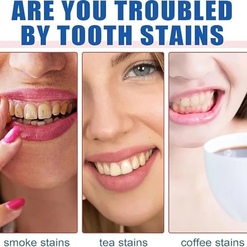 خمیر سفیدکننده دندان Fair Smile ارجینال — تصویر ۵