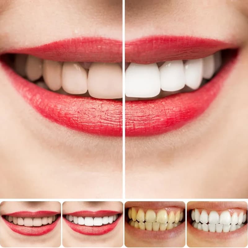 خمیر سفیدکننده دندان Fair Smile ارجینال — تصویر ۴