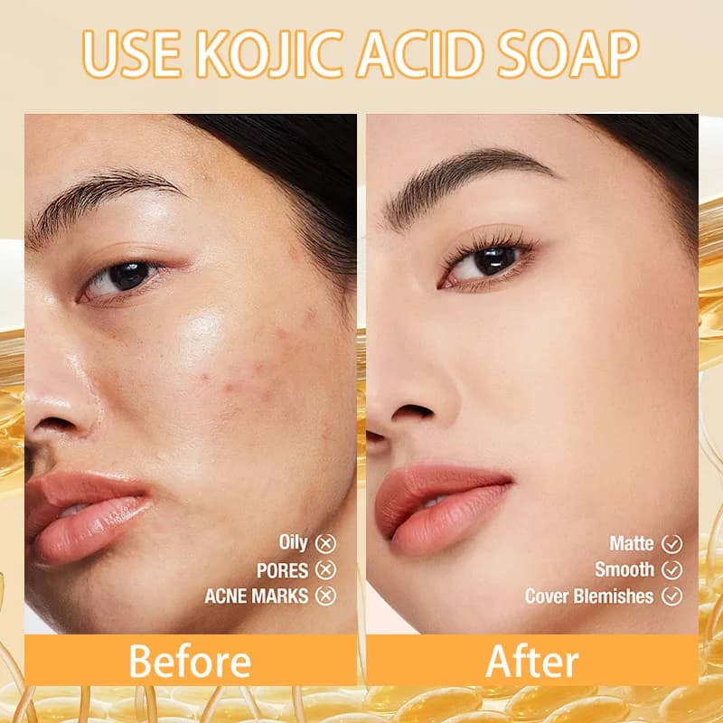 صابون کوجیک اسید روشن کننده قوی پوست صورت و بدن (روشون) — تصویر ۴