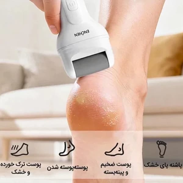 سنگ پای شارژی شیائومی Xiaomi Enchen Rock 2 — تصویر ۸