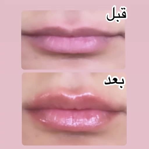 حجم لب هلو ان دبلیو و کاریتا — تصویر ۵