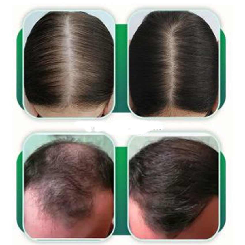 محلول تونیک رفع ریزش مو سر و ابرو 110 گرمی خرگوشک ساچ Khargushak — تصویر ۶