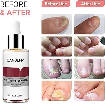 سرم تقویت ناخن لانبنا LANBENA — تصویر ۳