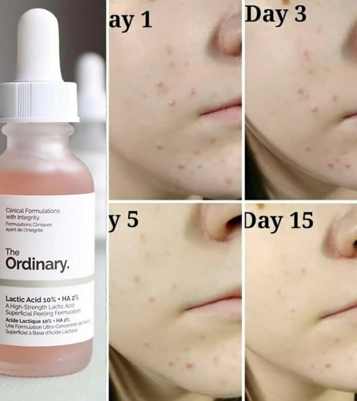 سرم لاکتیک اسید اوردینری 10% لایه بردار ملایم (30mL) — تصویر ۴