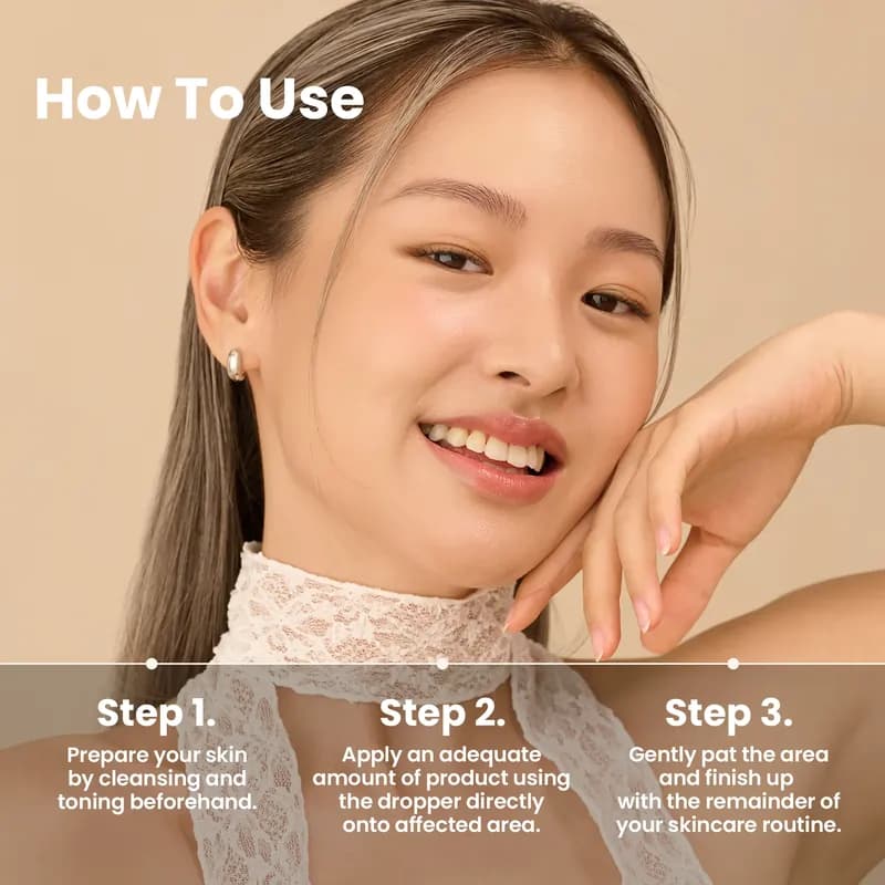 سرم ضد لک و ضد جوش اکسیس وای مدل Spot The Difference Blemish Treatment | حجم 15 میل — تصویر ۸