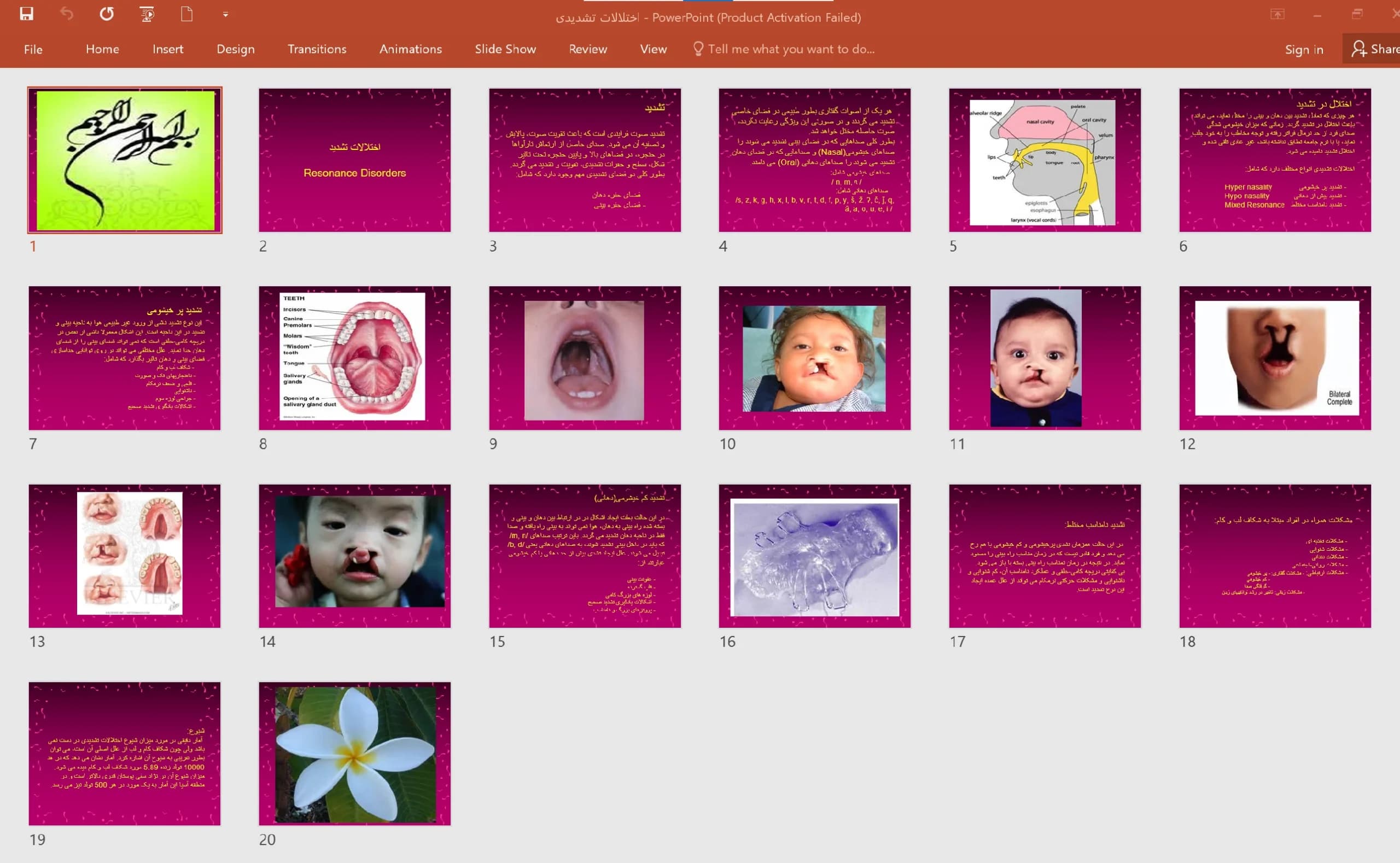 پاورپوینت اختلالات تشدید (Resonance Disorders) — تصویر ۶