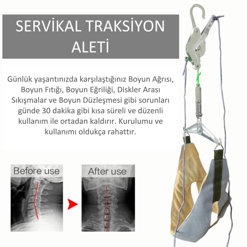 دستگاه کشش گردن INVOKER | مناسب برای درمان صاف شدن گردن، دردهای گردنی، اختلالات نشستن و فشار دیسک | طراحی ارگونومیک برای استفاده خانگی | کمک به بهبود وضعیت ستون فقرات گردنی | قابل تنظیم برای انواع سای — تصویر ۴