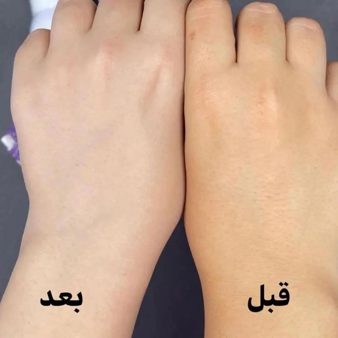 اسپری ضدآفتاب ایمیجز — تصویر ۹