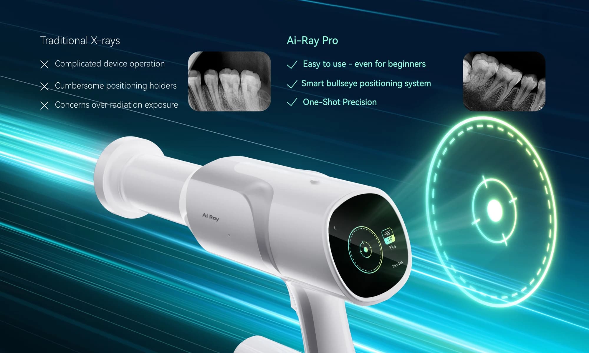 رادیوگرافی پرتابل Ai Ray Pro — تصویر ۳