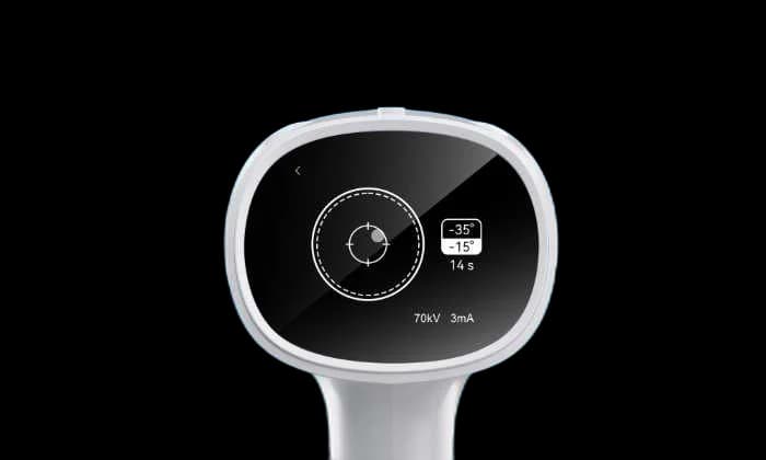 رادیوگرافی پرتابل Ai Ray Pro — تصویر ۸