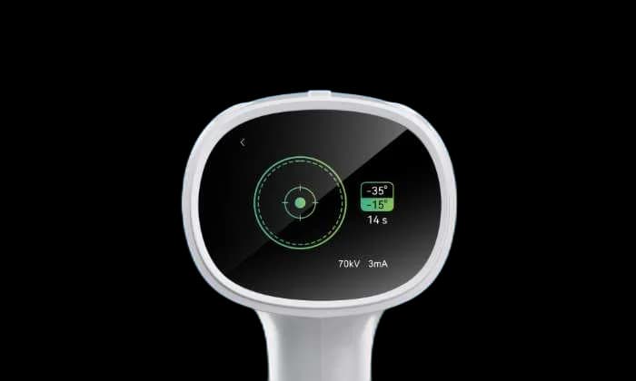 رادیوگرافی پرتابل Ai Ray Pro — تصویر ۶