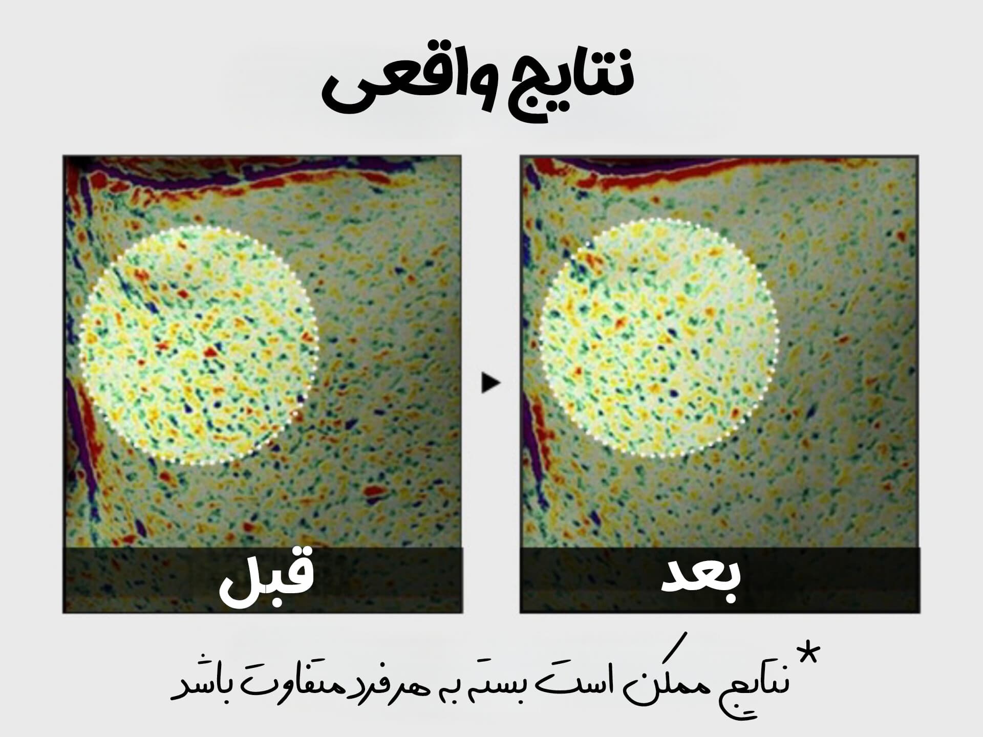 سرم ضد چروک رتینول مدی کیوب — تصویر ۴